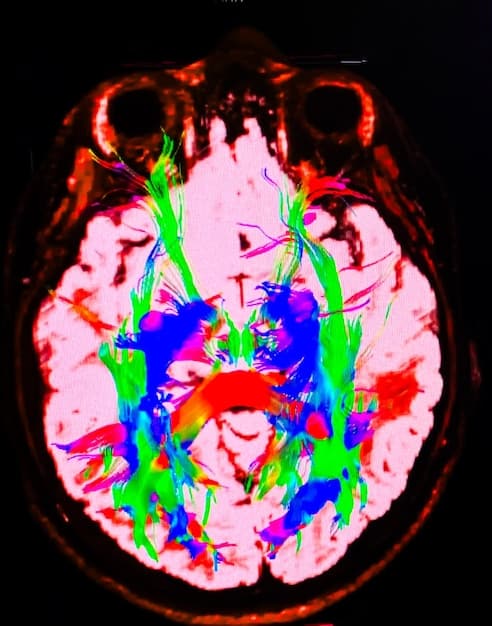 A close-up of a child's brain scan (MRI) highlighting specific areas affected by cerebral palsy. The scan should be clear and visually informative, with annotations pointing out key regions of interest.